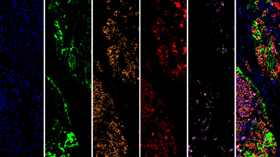多通道荧光同步采集，
一次获取完整信息