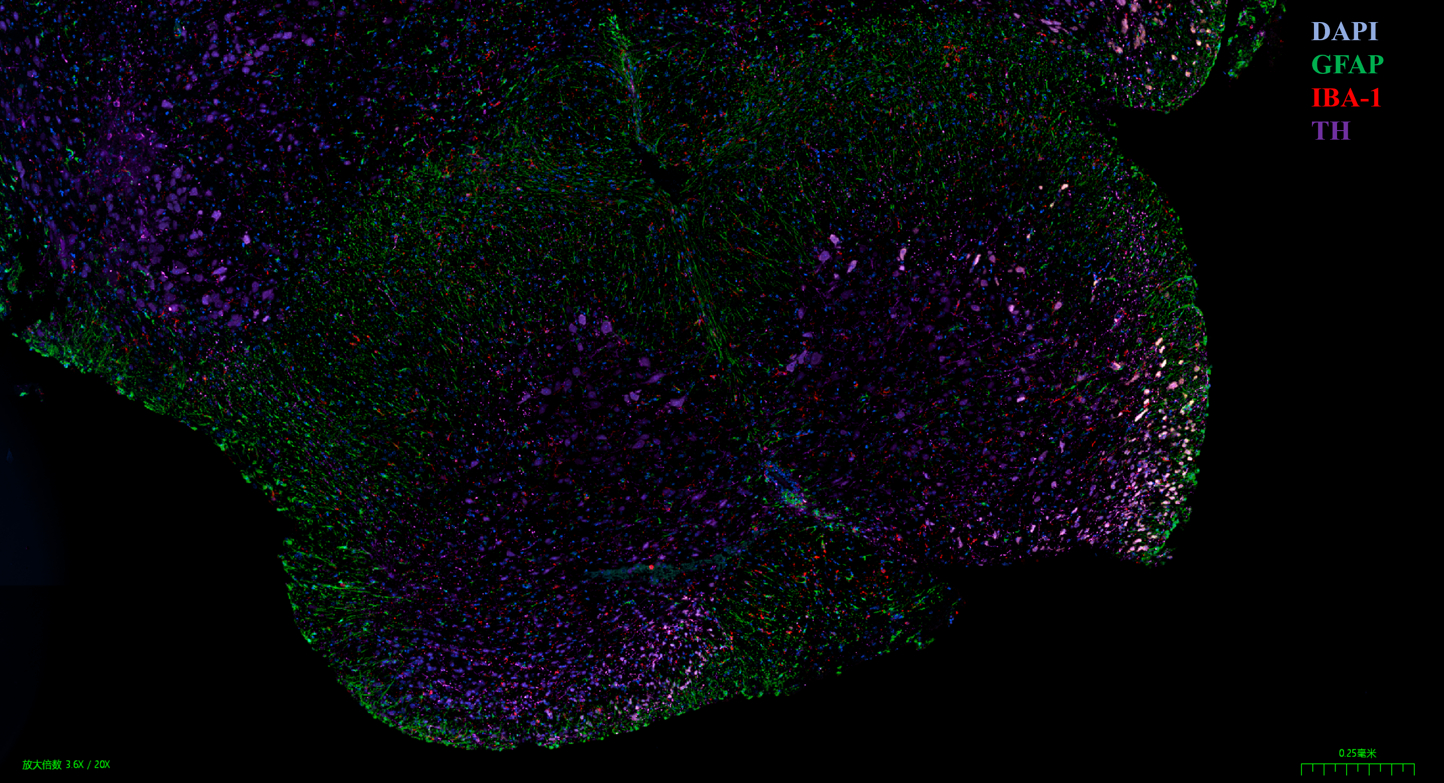 小鼠脑组织多重免疫荧光染色
使用20x NA 0.8 物镜成像
青色：DAPI ；绿色：GFAP；红色：IBA-1；紫色：TH；