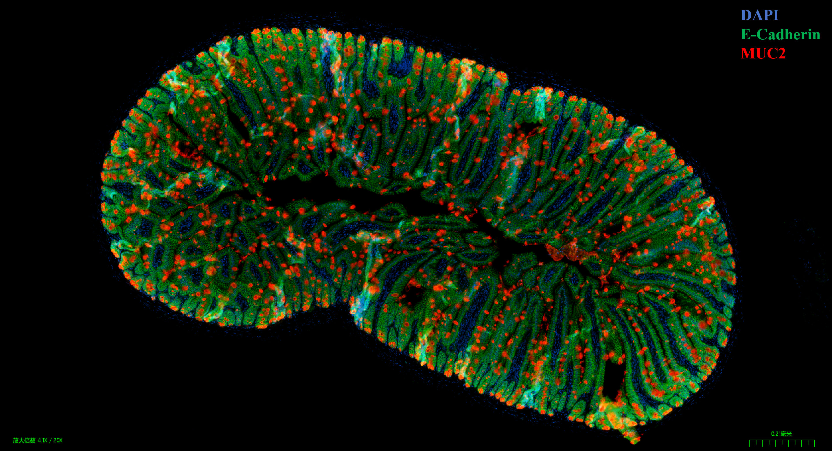 小鼠肠组织多重免疫荧光染色
使用20x NA 0.8 物镜成像
蓝色:细胞核，红色: Vimentin，绿色:E-Cadherin，紫色:MUC2；