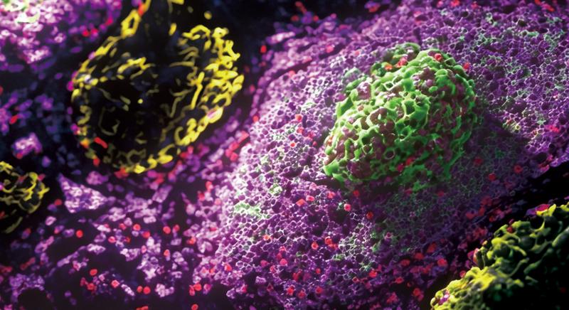 肿瘤组织三级淋巴结构 (TLS)